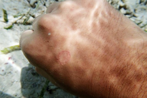 魚に噛まれた！