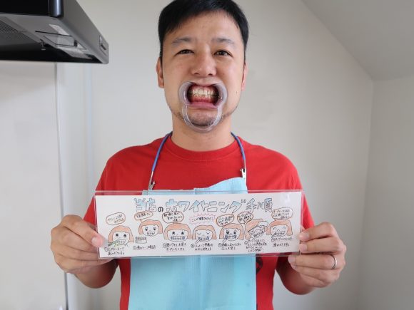 セルフホワイトニングの手順