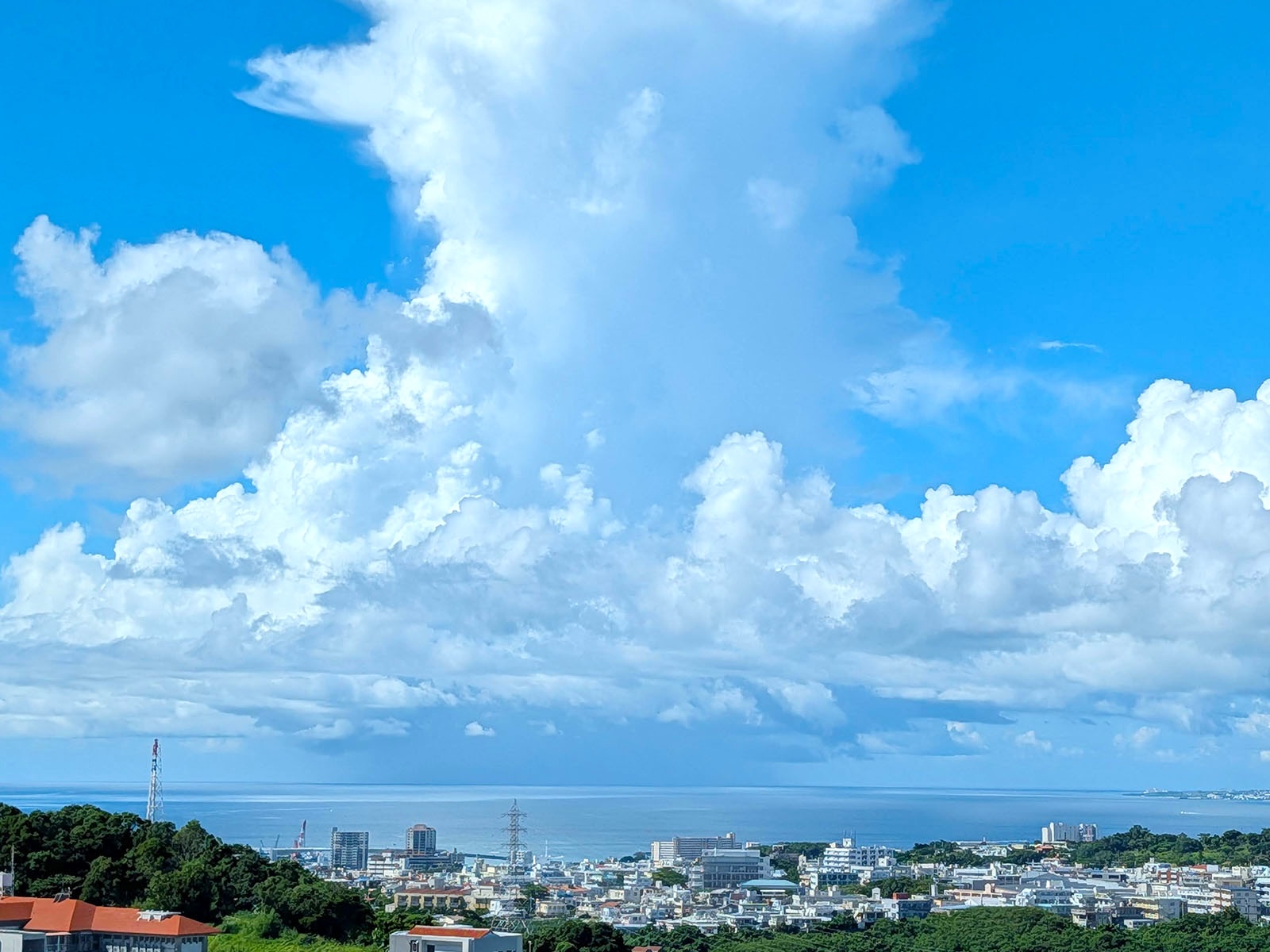 人生初の入院、手術をしてきました【虫垂切除腹腔鏡手術体験記】
